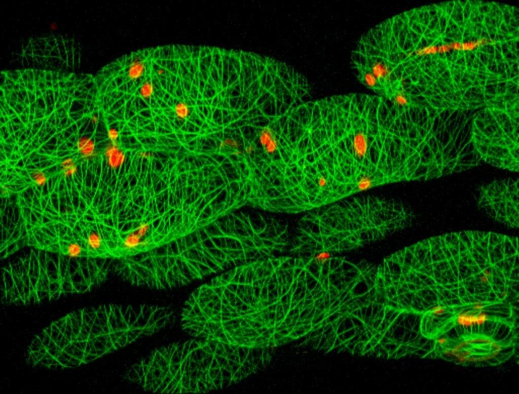 cells with microtubles fluorescing in green