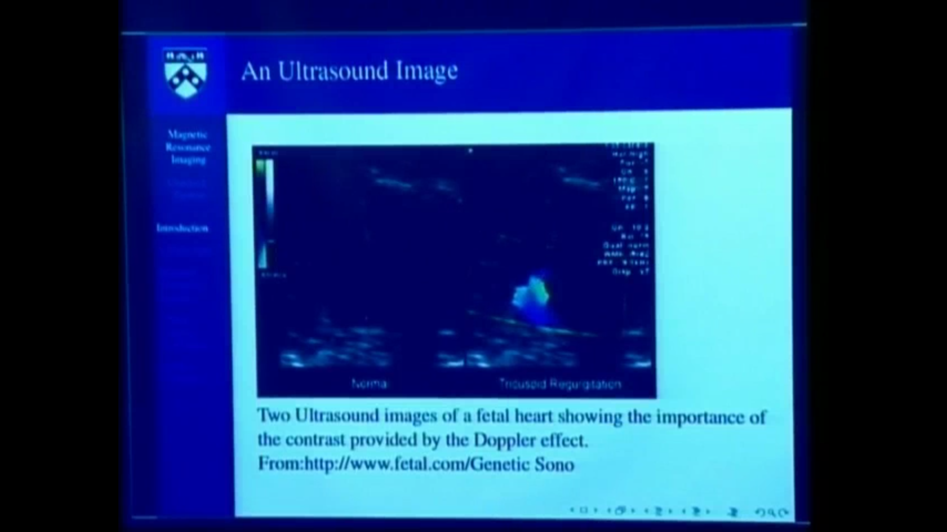 An Introduction to Magnetic Resonance Imaging I Thumbnail