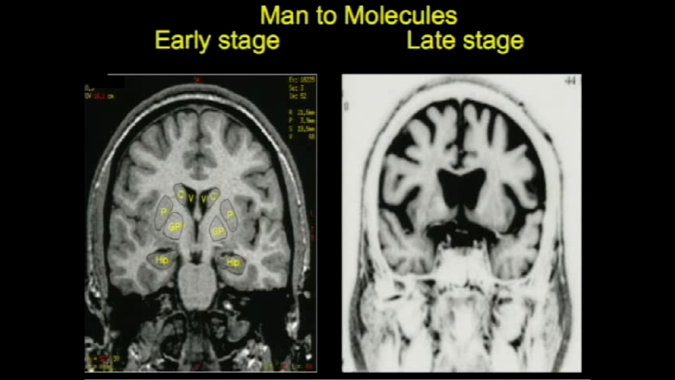 What multiscale imaging means to me Thumbnail